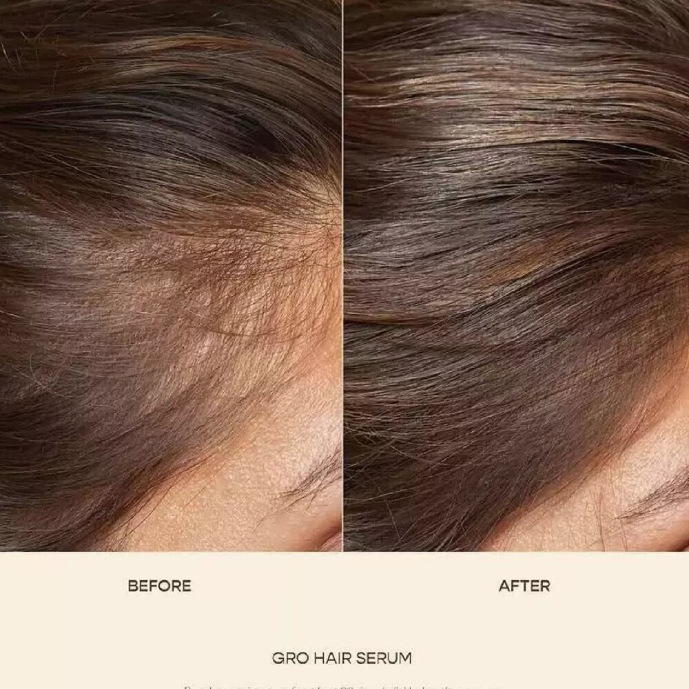 Vegamour Hair GRO Serum - Picture 4 of 7